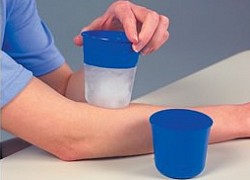 ICE MASSAGE THERAPY