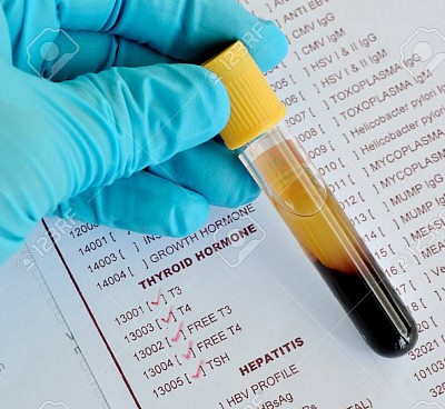 HORMONE TEST