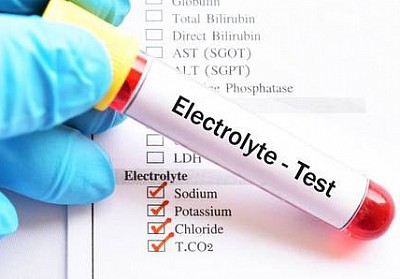 ELECTROLYTE TEST