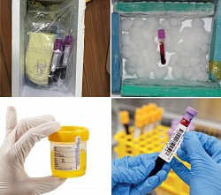 Reliable sample management